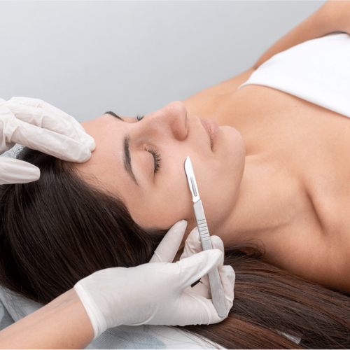 Dermaplaning