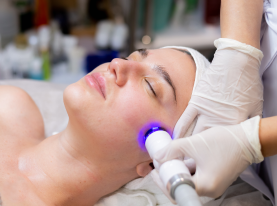 IPL Treatments