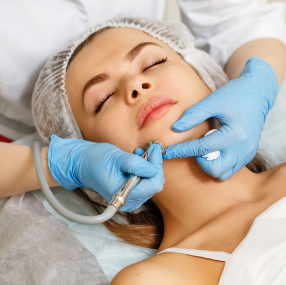 Microdermabrasion